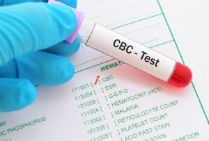 CBC (Complete Blood Count)