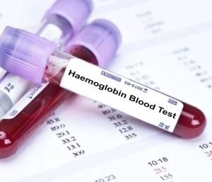 Hemoglobin (Hb%)