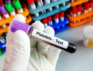 Platelet Count